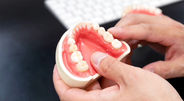 天然歯を守る保存治療